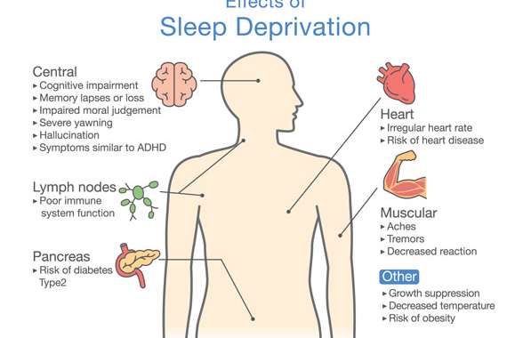 Sleep Deprivation and High Blood Pressure