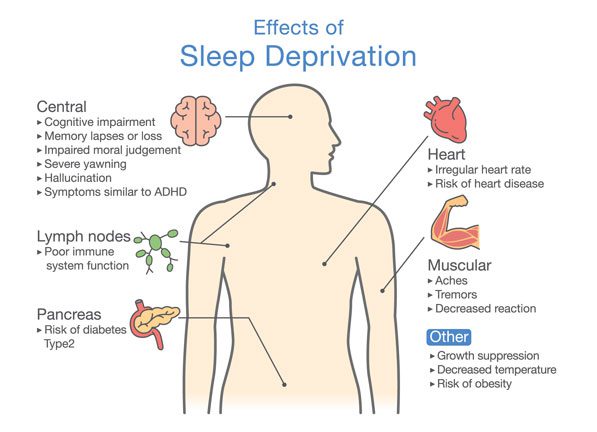 cartoon diagram of the effects of sleep deprivation has on the body